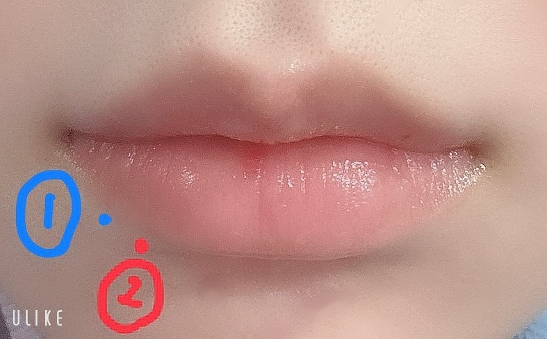 リップピアスを初めて開けました。開けてすぐです斜めすぎますかね