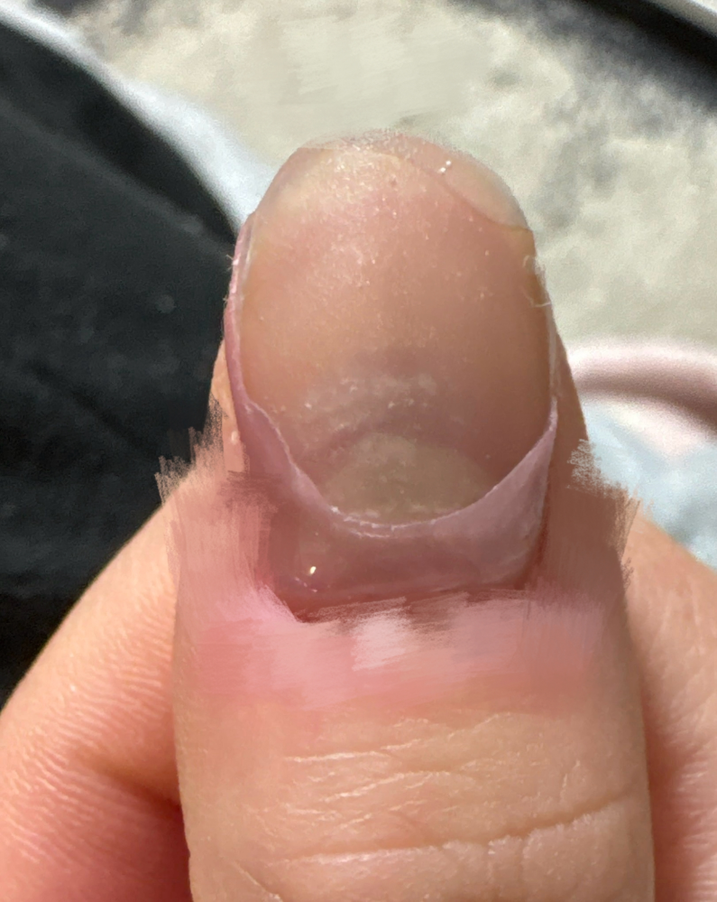 長さだしのチップが取れない方法を教えてください。 - ジェルネイルの