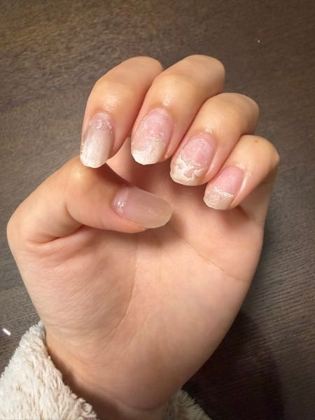 助けてください(；；)急遽ネイルを取らないといけなくなってサロン