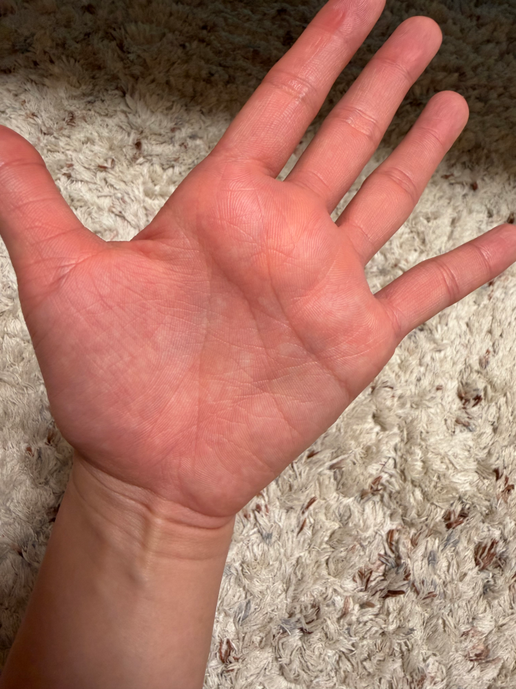手相を占ってください特殊したような線がないですが、生命線が大きく2