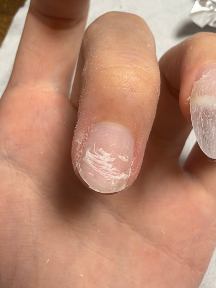 ネイル折れて自爪こんなんなったけど長さだしして平気ですよね