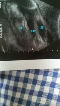 赤ちゃんの性別についての質問お願いします 妊娠33週目の赤ちゃんのお股の画像 Yahoo 知恵袋