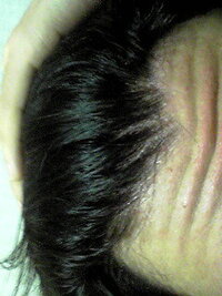 自分は髪を下ろしている時は全く薄く感じないのですが髪をあげると前髪の中央部分 Yahoo 知恵袋