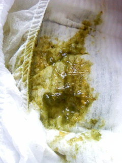 生後２ヵ月。これは下痢ですか？？生後２ヵ月の赤ちゃんです。母 