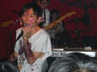神聖かまってちゃんのの子は何の病気なんですか 障害があるんでしょうか 昔 Yahoo 知恵袋