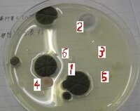 写真からカビの種類教えて下さい 授業で培養したカビの写真です 培地はポ Yahoo 知恵袋
