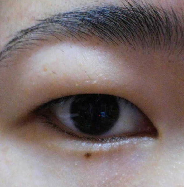 腫れぼったい目の解消法 画像あり 私は腫れぼったい目がコンプ Yahoo 知恵袋