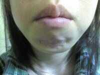 スマホで撮った写真をシワ消ししたり ホクロを消したり 左目を Yahoo 知恵袋