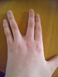 指についてなんですが 私の指は写真のようにくっつけることが出来ませ Yahoo 知恵袋