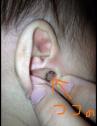 耳垢 赤ちゃん 赤ちゃんの耳垢がすごい…耳垢の正しい取り方・掃除方法とは?