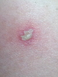 こんにちは 害虫駆除について質問です 今夏に入ってから ｱｵﾊ Yahoo 知恵袋