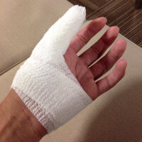 昨日爪が剥がれて 2 3ぐらい 処置してもらったんですけどすごく痛 Yahoo 知恵袋