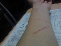 リストカットの跡がある男の人ってどうおもいますか また最近やりた Yahoo 知恵袋