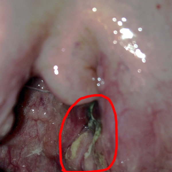 愚か 精神 一次 臭い 玉 黒い Fuzoku029 Jp