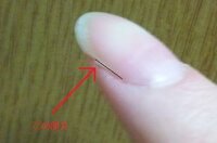 足の小指の外側の端っこに いつも小さい爪が生えてきます もとは一枚の爪だっ Yahoo 知恵袋