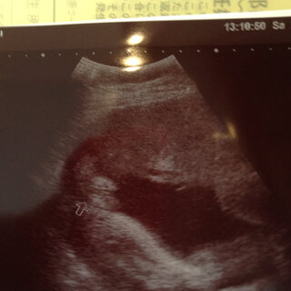 33w妊婦です 赤ちゃんの性別についてお聞きしたいです ずーっと女の Yahoo 知恵袋