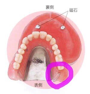 奥歯の奥の歯茎から歯がはえてきました 閲覧ありがとうございます 奥歯 Yahoo 知恵袋