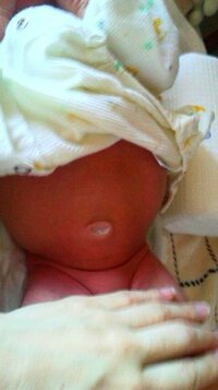 新生児のお腹ってどんなですか うちの赤ちゃんは 生後三週間経ち Yahoo 知恵袋