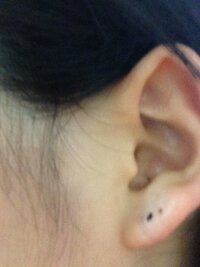 ピアスホールこの位置だと上すぎでしょうか ２つ印が見えますが 下の黒い Yahoo 知恵袋