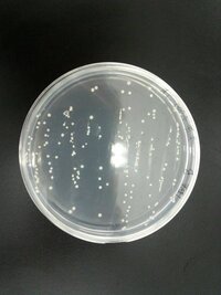 表皮ブドウ球菌 卵黄加マンニット食塩培地で 黄色ブドウ球菌が出た Yahoo 知恵袋