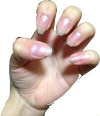 この汚い爪を綺麗にネイルをしないで整えたいんですが どうすればいいで Yahoo 知恵袋