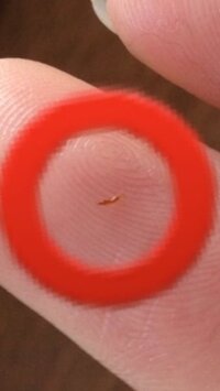 鼻を指で押すとニョロニョロと白いものが毛穴から出てきます 何なん Yahoo 知恵袋