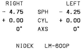 眼鏡の視力矯正値データ Sph Cyl Axs の内容についての質問 Yahoo 知恵袋