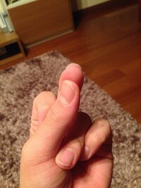 爪の裏と皮膚との間に皮 みたいなのが張り付いていて 爪が切れません Yahoo 知恵袋