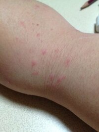 アレルギー 症状 猫