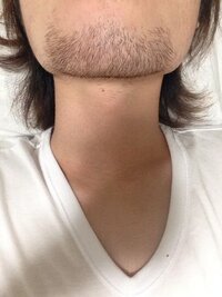 一週間髭伸ばしました 8月で22歳になります この濃さは将来ほっぺの毛ボ Yahoo 知恵袋