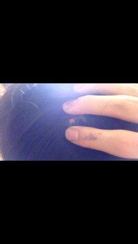 坊主にしようとしているのですが 頭の後頭部に画像のようないぼがありま Yahoo 知恵袋