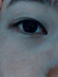 二重まぶたの種類を教えてください。

また、私の瞼はどの種類に当てはるのでしょうか？

ノーメイクの写真です。 
