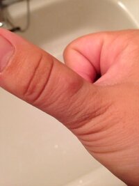 絵を描く方ってペンだこができている方が多いですか わたしはあります Yahoo 知恵袋