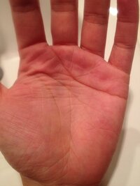 この奇妙な手相を教えてください 左手薬指と小指の間下部にあるリボンの Yahoo 知恵袋
