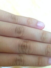 指にシワ 高2女子です 生まれつきか かなり前か いつ入ったかはわかり Yahoo 知恵袋
