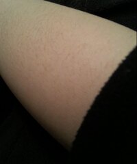 中学生女子です わたしは毛深いのを気にしてます 海外に住んでるのでレ Yahoo 知恵袋