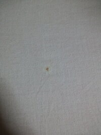 何の虫の卵か教えて下さい 茶色の種みたいな物が毛布にくっついていました 潰 Yahoo 知恵袋
