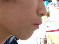 写真のように口が出ています自力で引っ込める方法はありますか 出 Yahoo 知恵袋