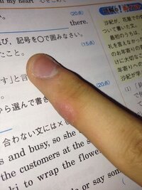 小指外側のペンだこについて 私には8年前から 中学受験の受 Yahoo 知恵袋