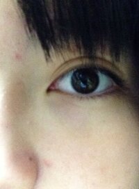 片方だけ目が二重なのはむしろ個性的で魅力だと思えるのですがどうでしょうか Yahoo 知恵袋