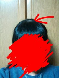 正面から見るとはげて見えます 前髪と後ろ髪の間の分け目の部分です ど Yahoo 知恵袋