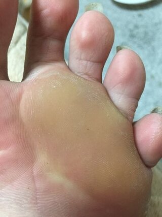 裏 足 黄色い の が