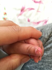生後3カ月の赤ちゃん 私が爪を切りすぎてしまった様で 爪の中にばい菌が入り 膿 Yahoo 知恵袋