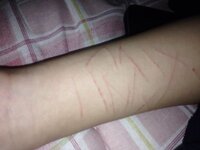 写真が少し気持ち悪いかもしれません 私は 今腕に傷があります で Yahoo 知恵袋