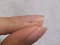 グリーンネイルについて 二週間ほど前に初めてセルフでジェルネイルをし Yahoo 知恵袋