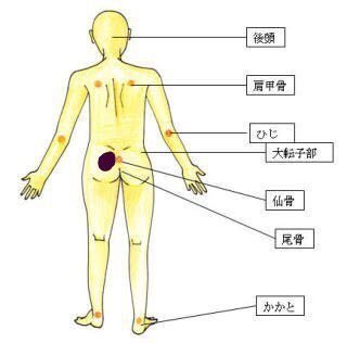 階段で滑り 尻もちをついてしまいました 昨日の朝方のことです 全体重をお Yahoo 知恵袋