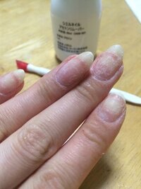 急ぎです 初めてジェルネイルをオフしたら 写真のように白くガサガサ Yahoo 知恵袋
