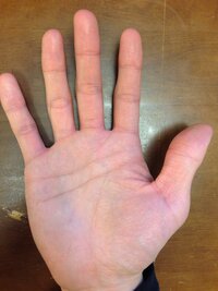 右手だけ頭脳線がグンっと伸びていますが これってマスカケ線でしょうか マスカケ Yahoo 知恵袋