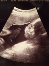 今 妊娠８カ月です 1週間前の妊婦健診でエコーを見たら胎児がベロを出 Yahoo 知恵袋