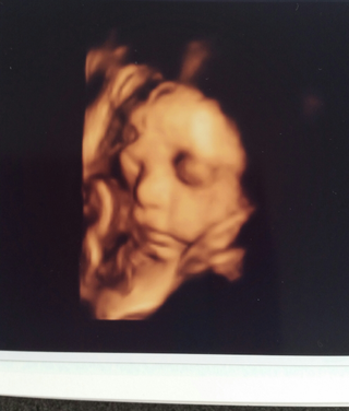 妊娠9ヶ月のエコー写真です 先日やっと顔がはっきりと見え主人とど Yahoo 知恵袋